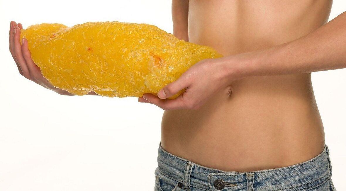 Gadis gemuk dan kurus manusia